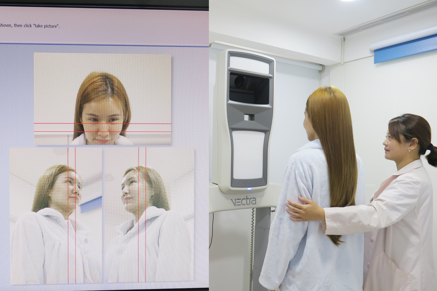 模擬韓式隆鼻手術-東京風采整形外科診所