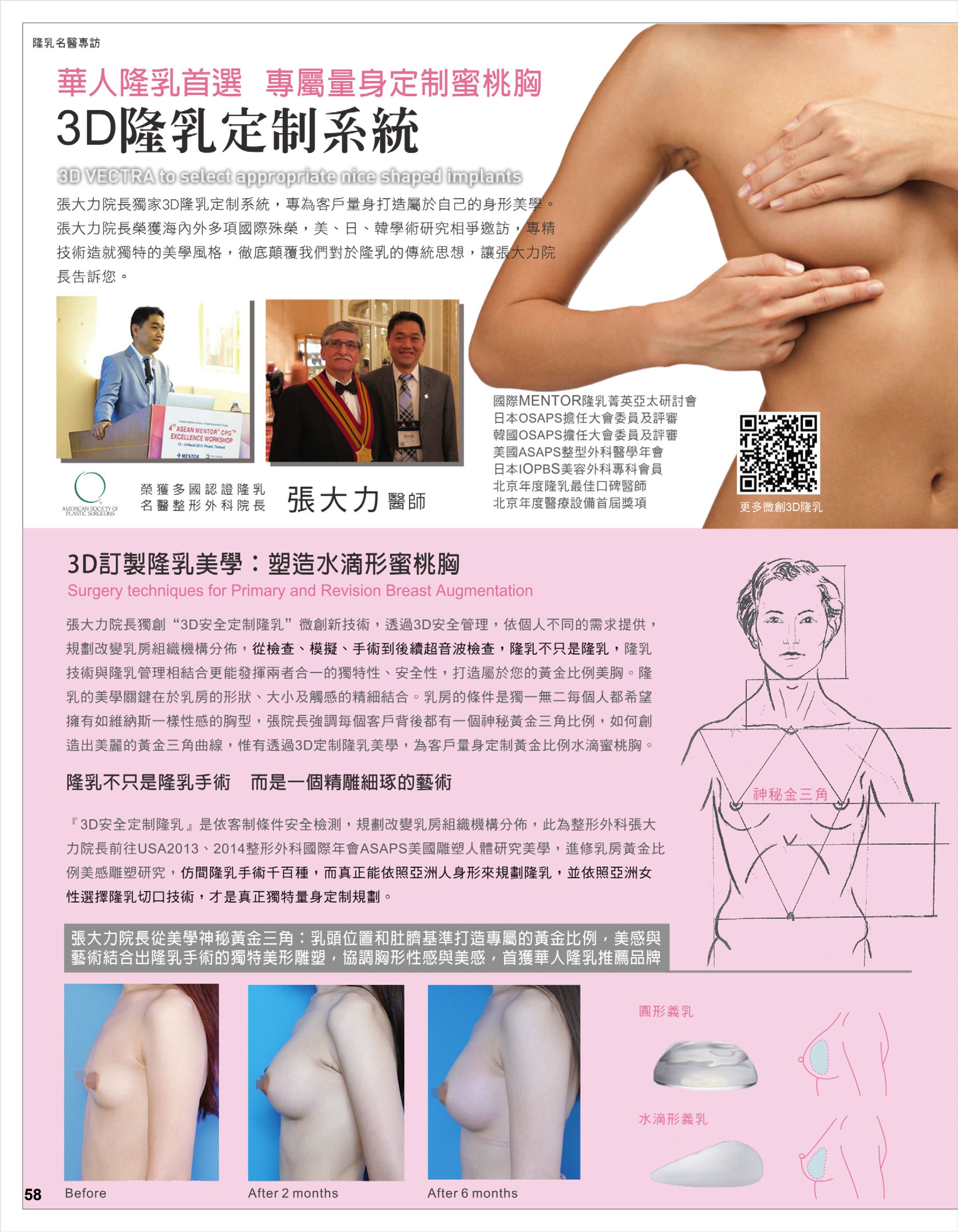 3D隆乳量身訂製蜜桃胸 -雜誌專訪-張大力-整形名醫-東京風采