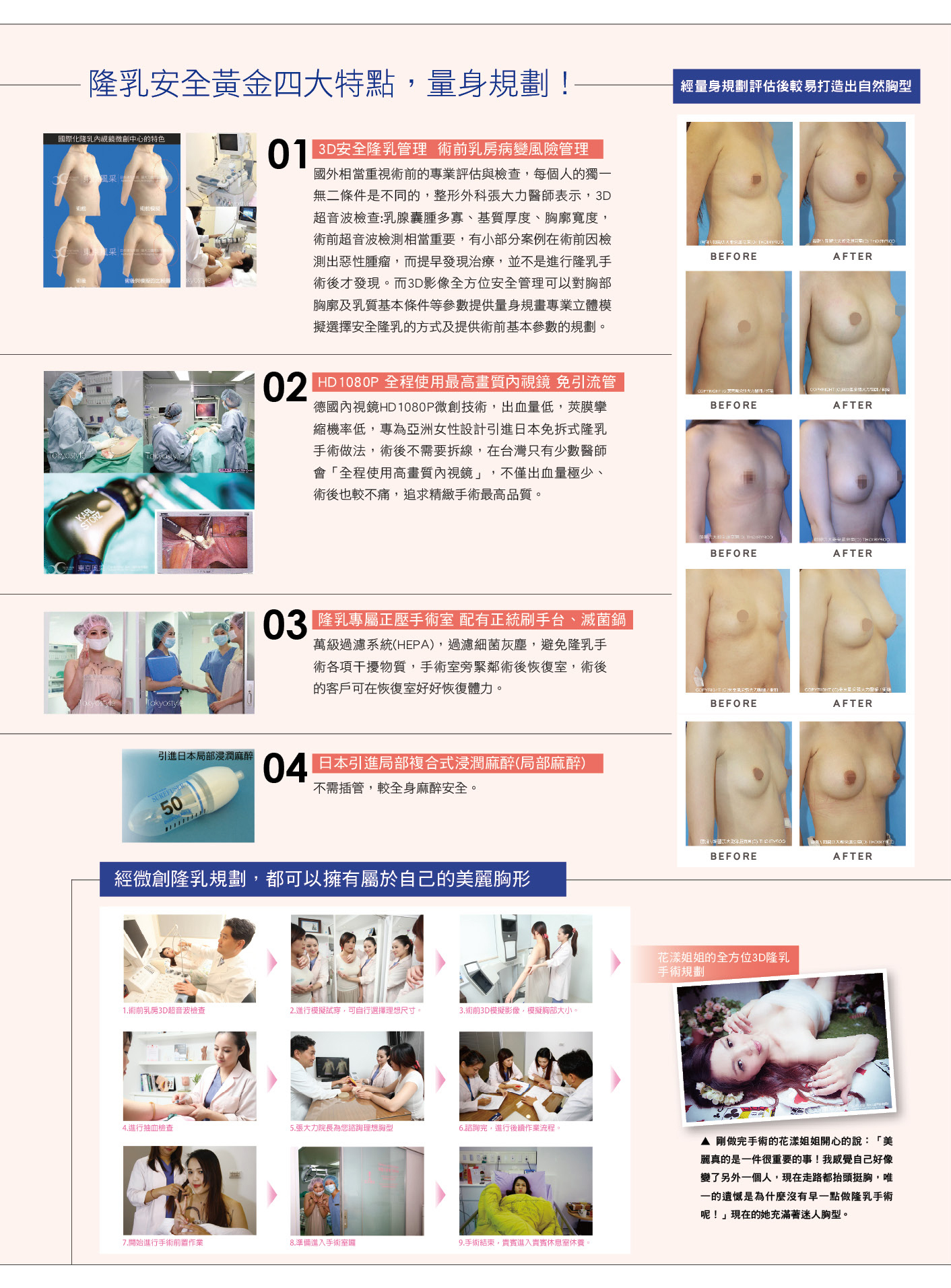 自體脂肪隆乳 醫師沒說的秘密-雜誌專訪-張大力-整形名醫-東京風采