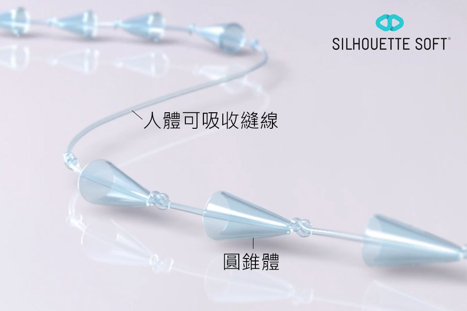圓錐線拉提 (Silhouette Soft)