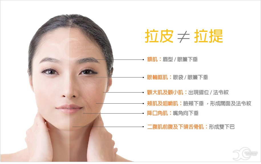 拉皮≠拉提